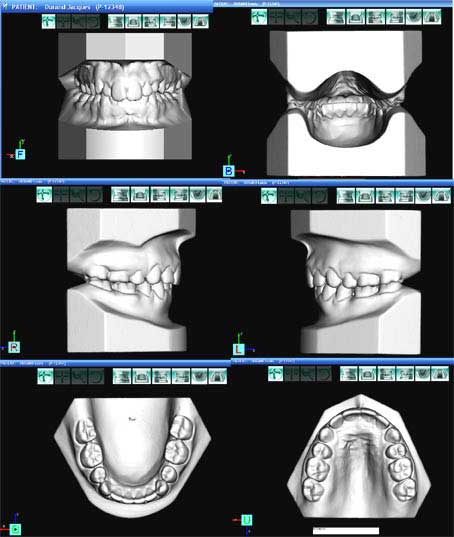 fig.15